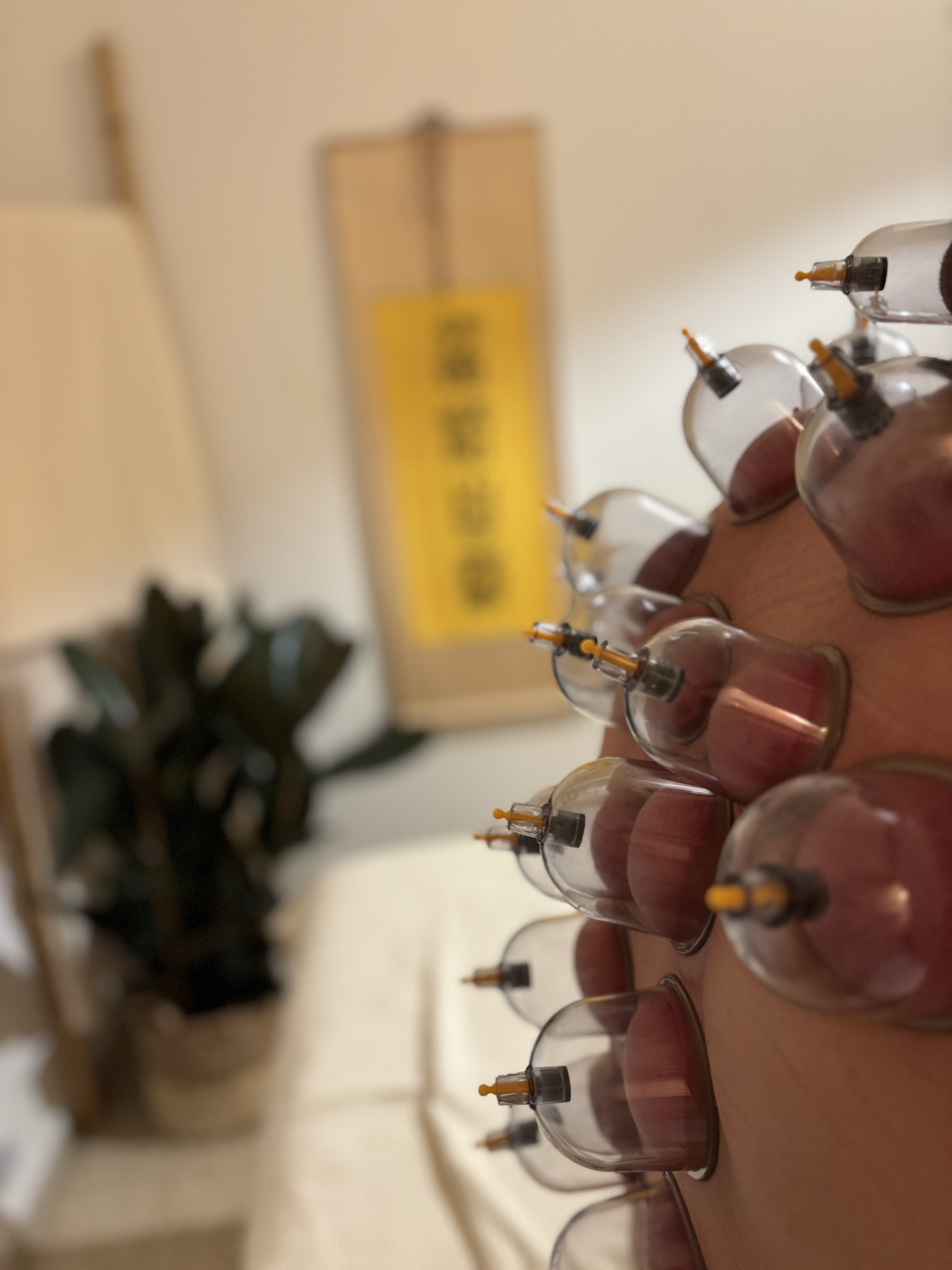 עידן גז׳בין -רפואה סינית ושיאצו image 5