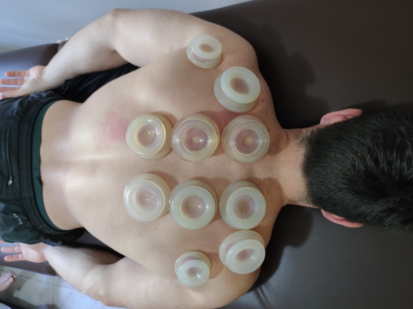 תום מור - רפואה סינית image 2