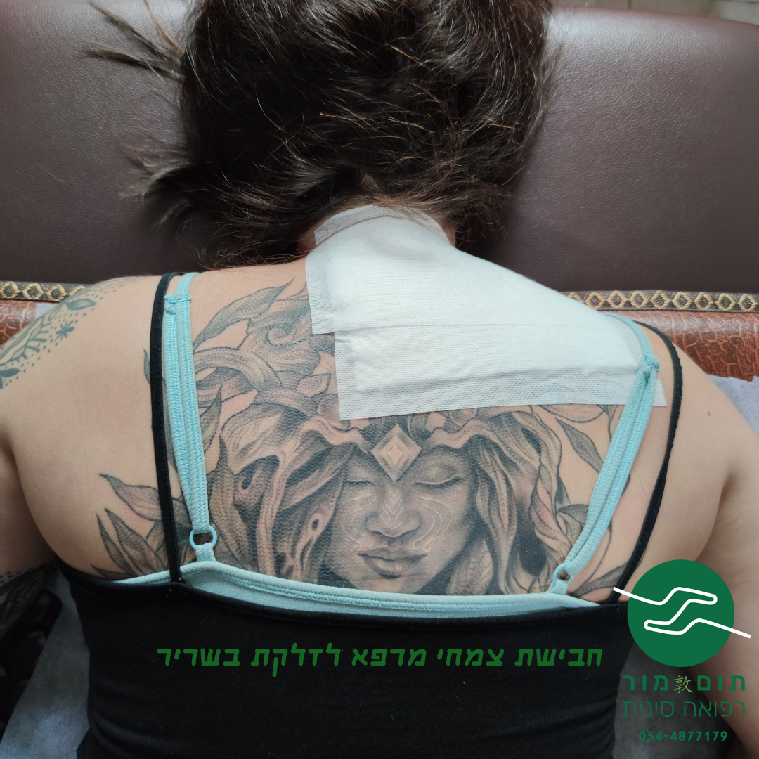 תום מור - רפואה סינית image 5