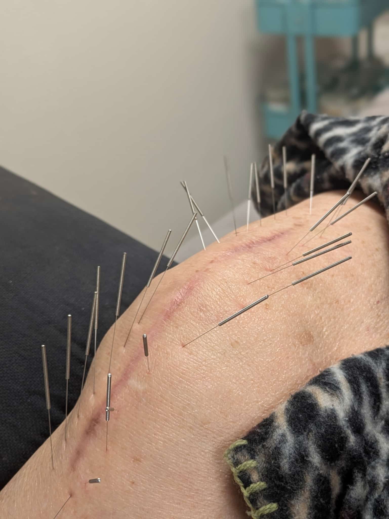 צור ורדי - שנים צ'י-נים image 2