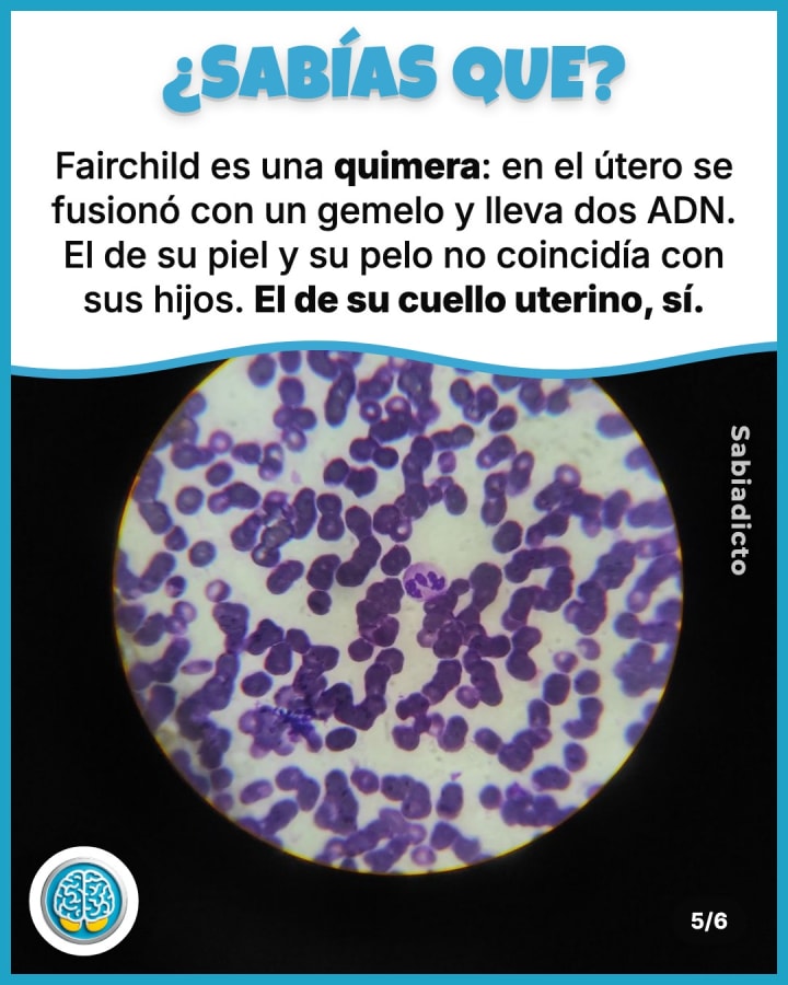 Fairchild es una quimera: en el útero se fusionó con un gemelo y lleva dos ADN. El de su piel y su pelo no coincidía con sus hijos. El de su cuello uterino, sí.