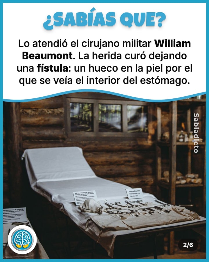 Lo atendió el cirujano militar William Beaumont. La herida curó dejando una fístula: un hueco en la piel por el que se veía el interior del estómago.