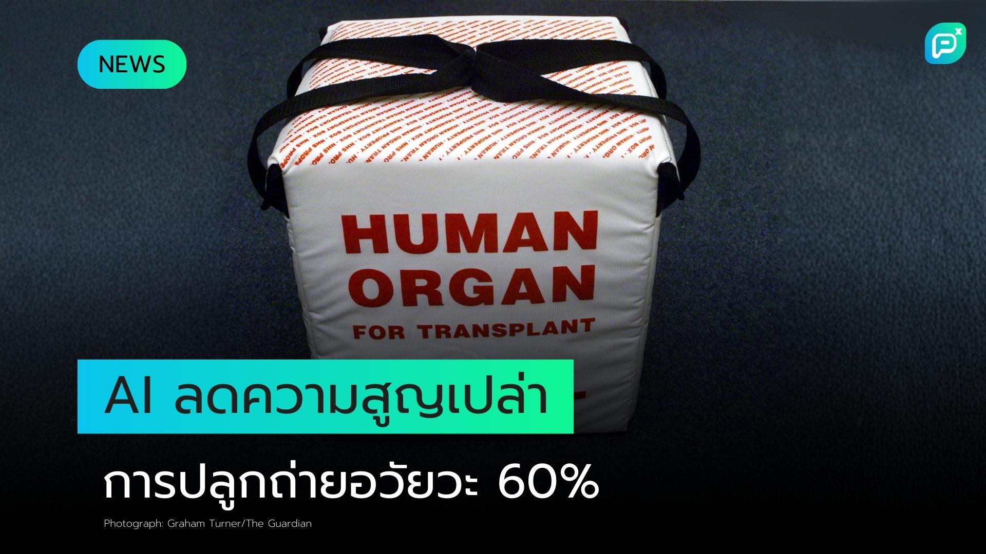 เครื่องมือ AI ใหม่อาจลดความสูญเปล่าในการปลูกถ่ายอวัยวะได้ถึง 60%