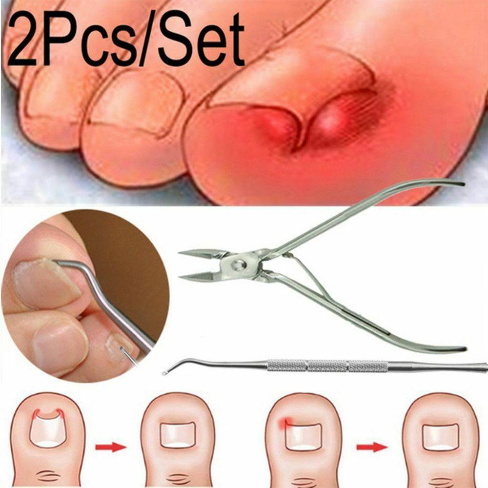 Premium Toe Nail Fixer Set Pakistan | Stainless Steel Ingrown Toenail & Dead Skin Remover