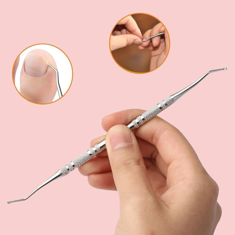 Premium Toe Nail Fixer Set Pakistan | Stainless Steel Ingrown Toenail & Dead Skin Remover