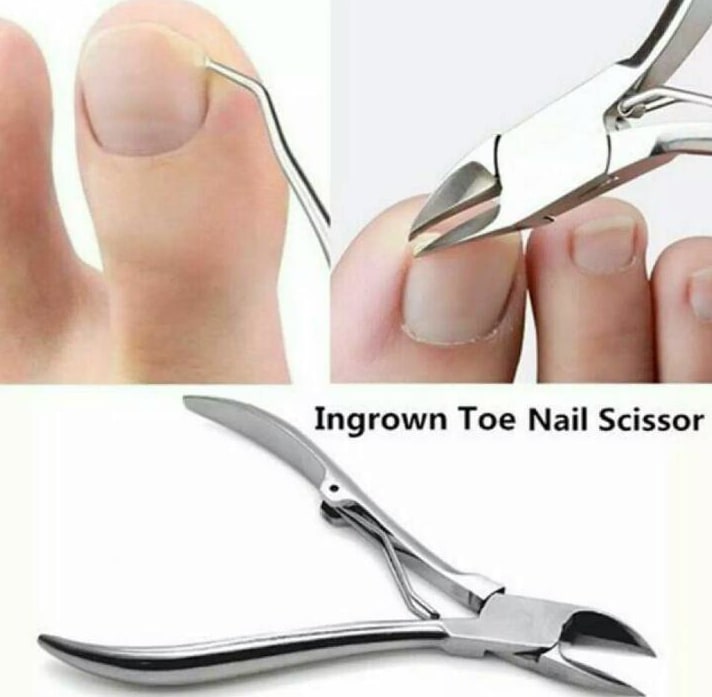 Premium Toe Nail Fixer Set Pakistan | Stainless Steel Ingrown Toenail & Dead Skin Remover