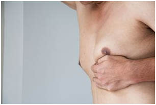 male breast reduction surgery in pitampura