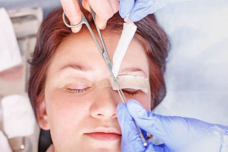 eyelid-surgery-in-delhi