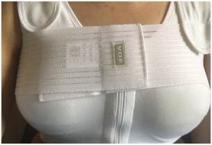 plastic-surgery-in-delhi