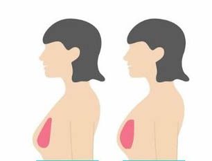 cosmetic-surgeon-in-delhi