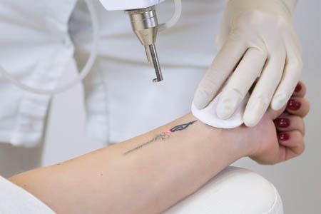 THE BEST 10 Tattoo Removal in San Antonio TX  Last Updated August 2023   Yelp