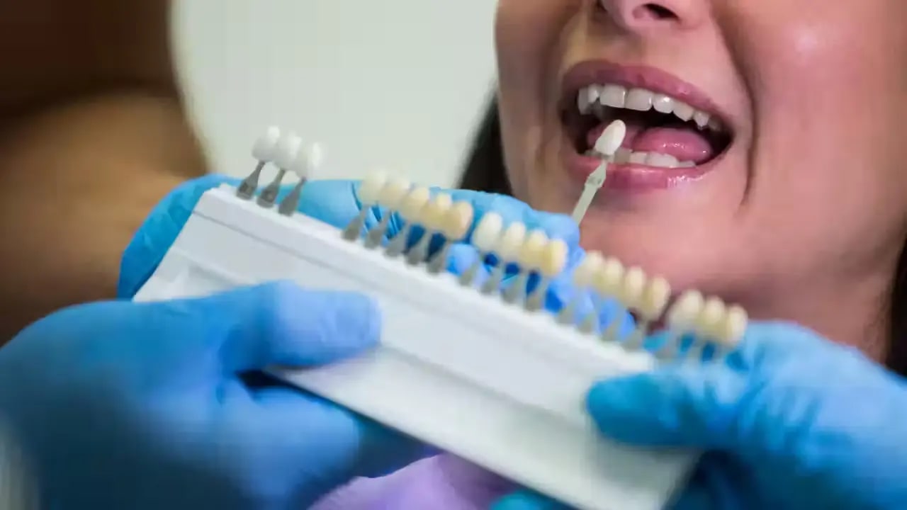 How to Maintain Your Dental Implants for a Lifetime
