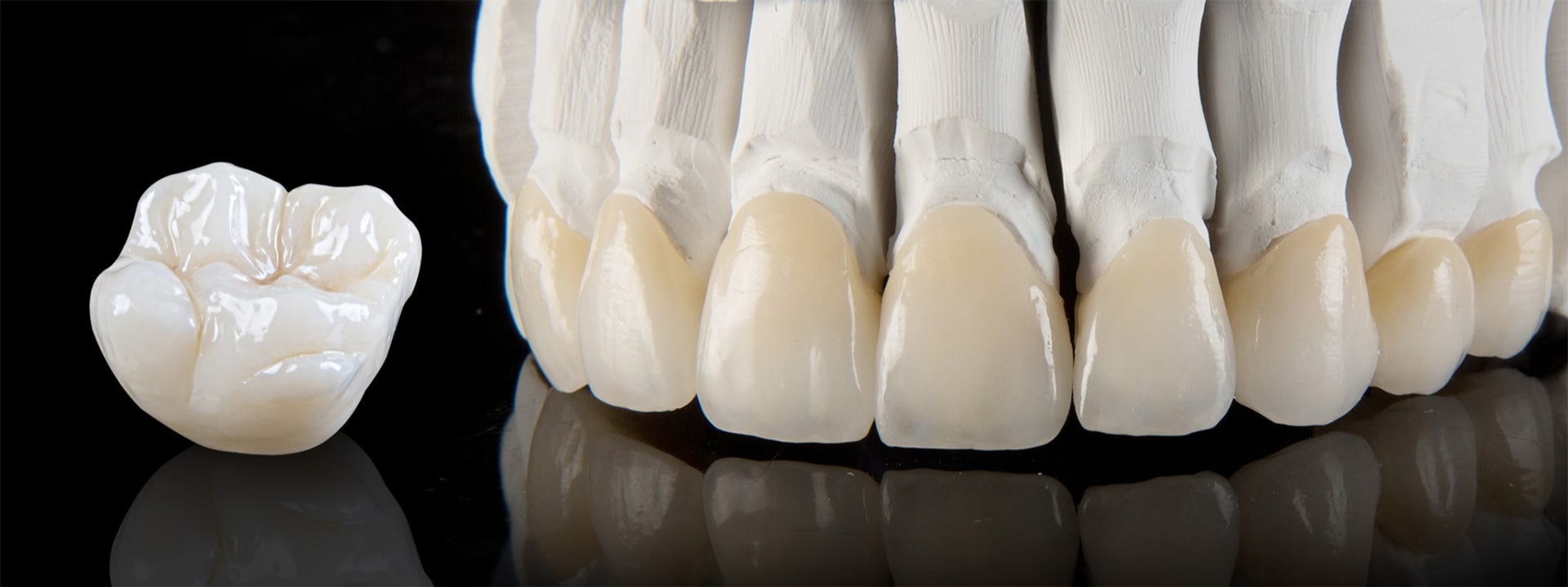 Crown/Capping & Fixed Bridge Works (Metal, PFM, Full Ceramic)