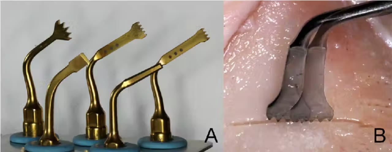 Piezoelectric Surgery