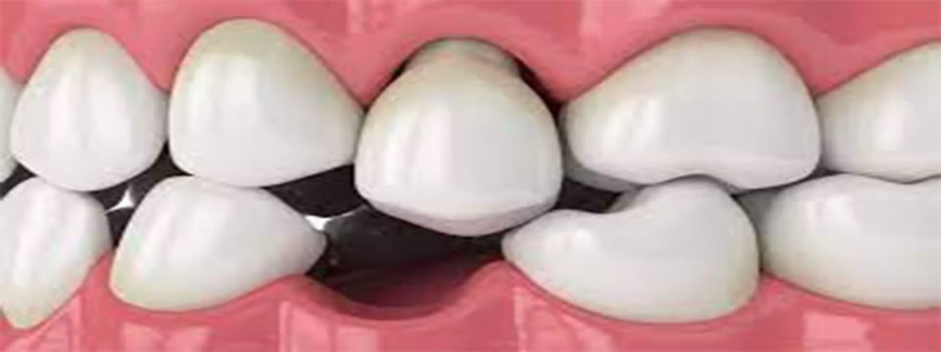 Treatment Of All Kinds Of Oral And Dental Diseases