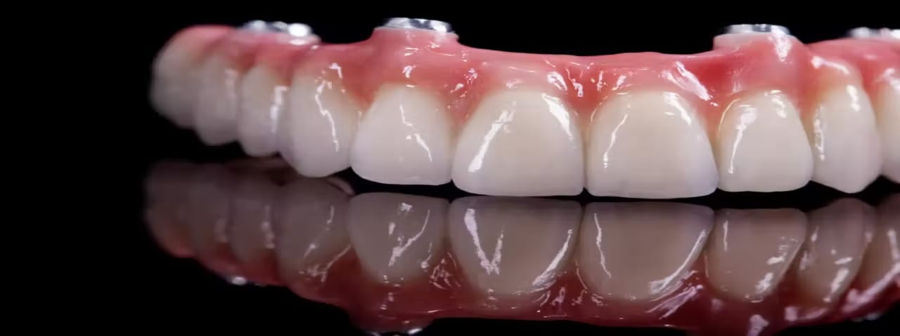 Maxillofacial Prosthesis