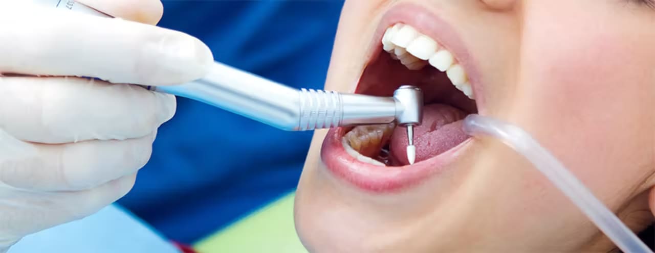 Painless Tooth Extraction