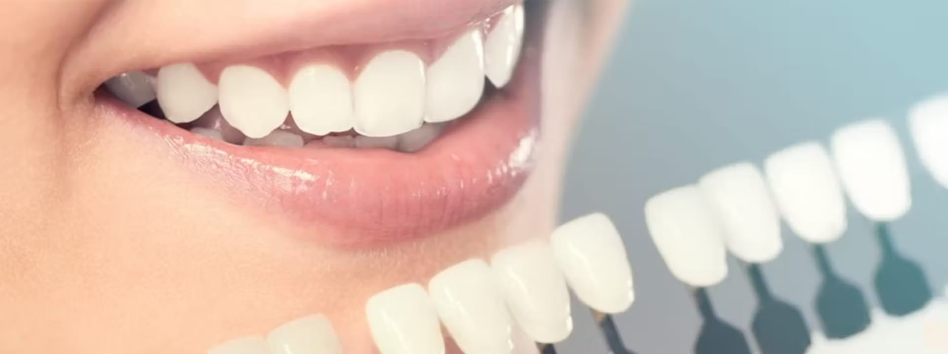 Cosmetic Intraoral Surgery