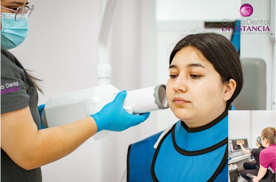 Implante dental Talca: solución confiable y precisa