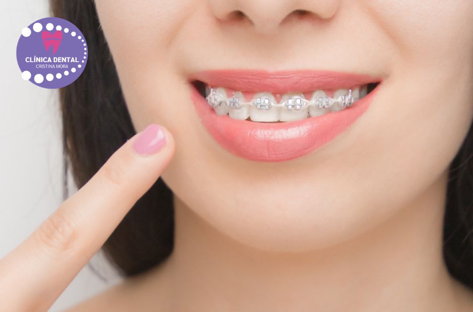 Implantes Dentales Gines – Sona amb confiança a Clinicadentalcristinamora