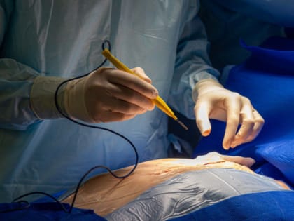 Кардиохирурги ЧОКБ подарили новое сердце пациенту, перенёсшему три инсульта за год