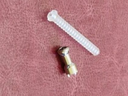 В детской больнице хирурги при переломах устанавливают саморассасывающиеся винты