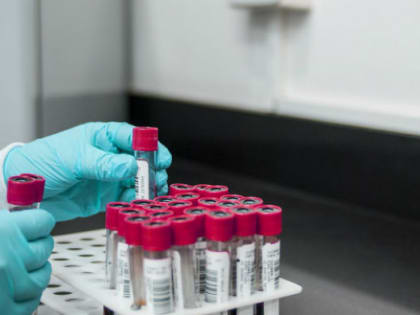 Показатели заболеваемости COVID-19 в Челябинской области упали до рекордных значений