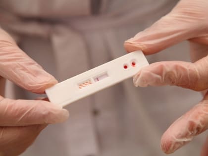 Копейчане смогут бесплатно пройти тест на ВИЧ