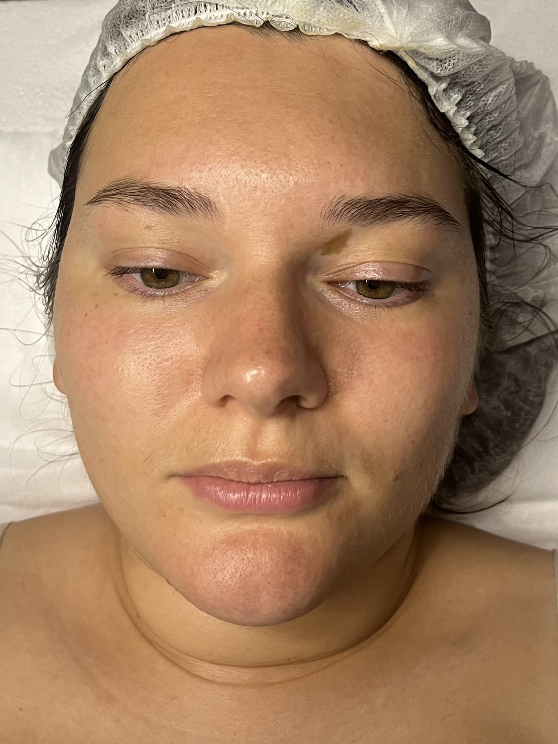 After post-winter reset facial showing hydrated, glowing skin
