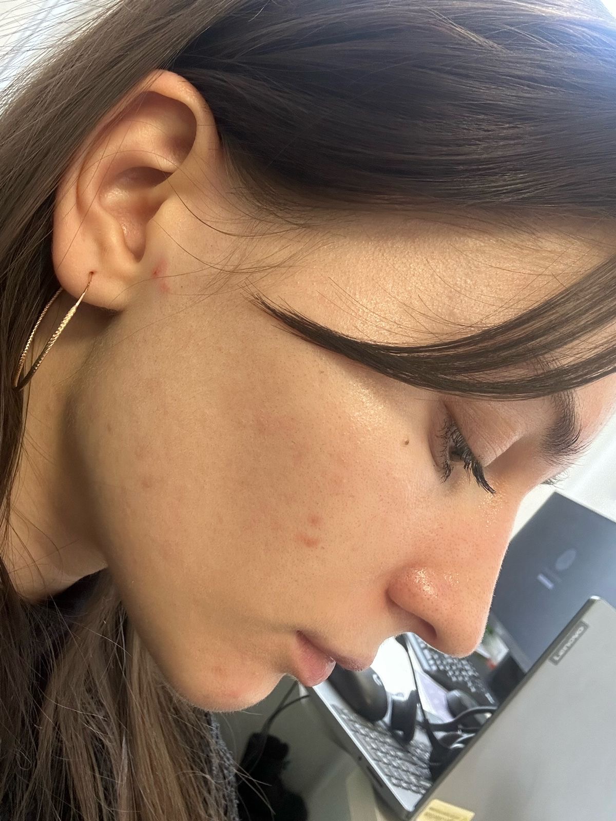 Before reset protocol and home skincare routine