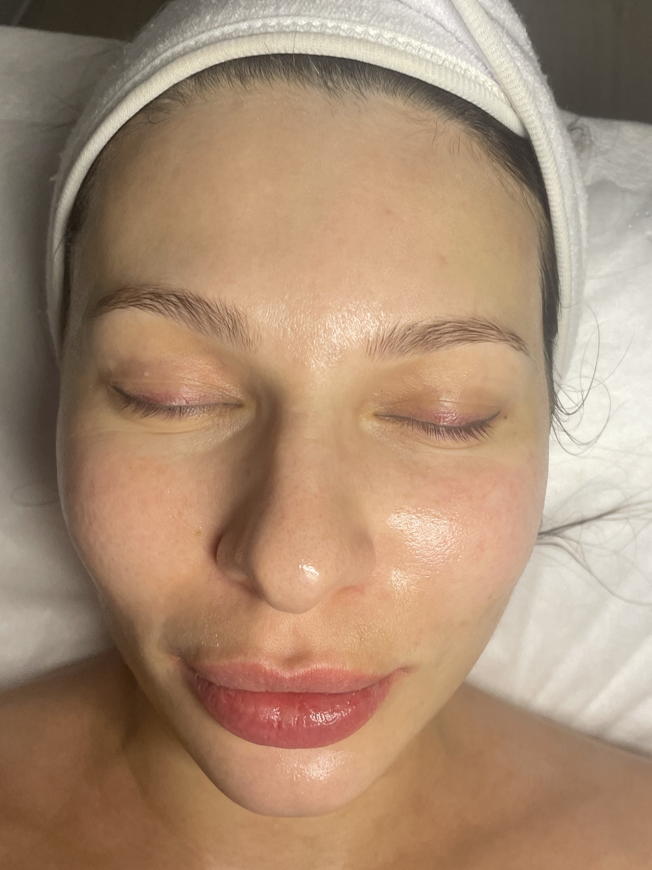 After post-winter reset facial showing hydrated, glowing skin