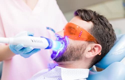 Teeth Whitening