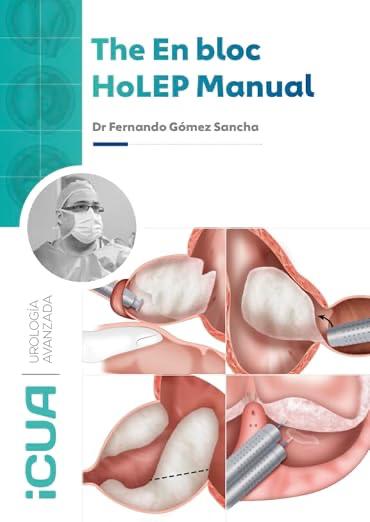The En Bloc HoLEP Manual