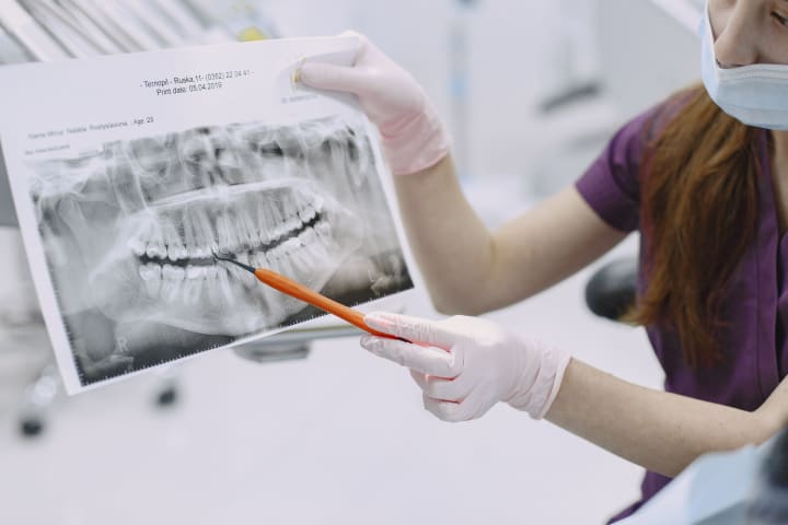 Dentist explaining dental X-ray findings to a patient during a consultation.