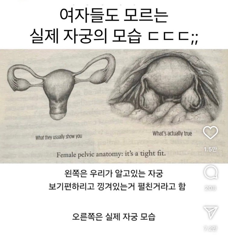 {자궁의 실제 모습 비교 이미지}