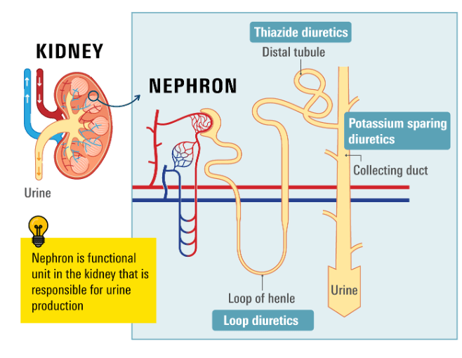 Diagram showing how diuretics inhibit reabsorption of sodium and water, leading to increased urine production