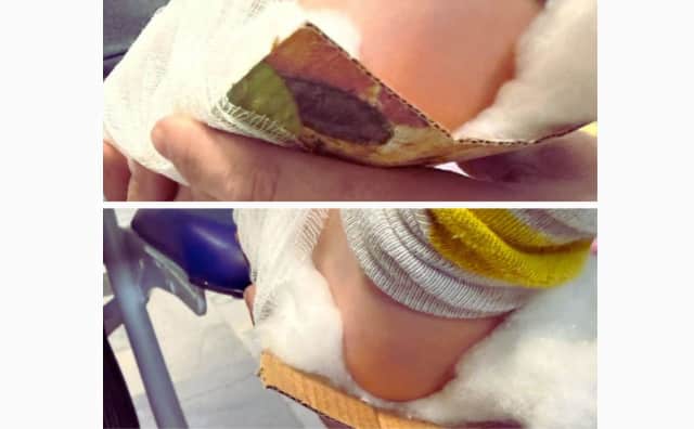 Bulgaristan'da Akıl Almaz Vakalar: Çocukların Kırık Kemikleri Pizza Kutusuyla Sabitlendi