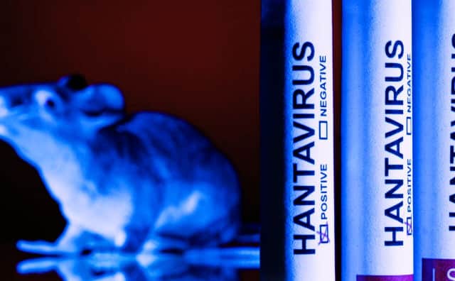 Epidemiyologdan Hantavirüs Açıklaması: Bulgaristan İçin Büyük Bir Risk Yok
