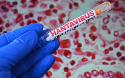 Hantavirüs Belirtileri 'Stres' Denilerek Göz Ardı Edilen Fransız Yolcu Kritik Durumda