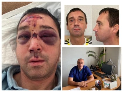 Ярославские врачи восстановили лицевые кости упавшему с велосипеда мужчине