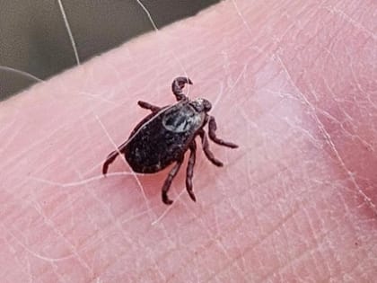 Названы самые опасные по клещевым инфекциям районы Ярославской области