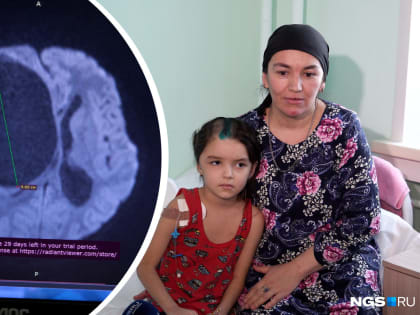 «В буквальном смысле промыли мозг»: у 5-летней девочки в голове нашли огромную кисту с червем — видео операции без скальпеля