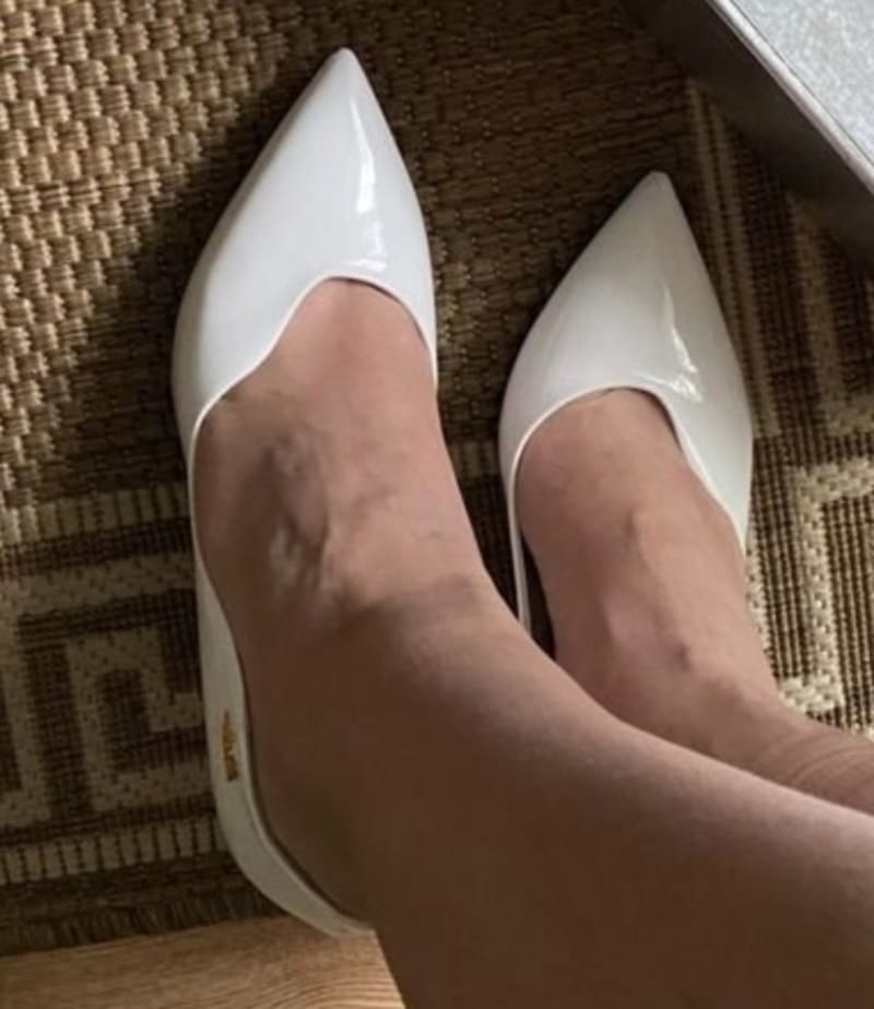 Туфельки Loriblu - фото 2