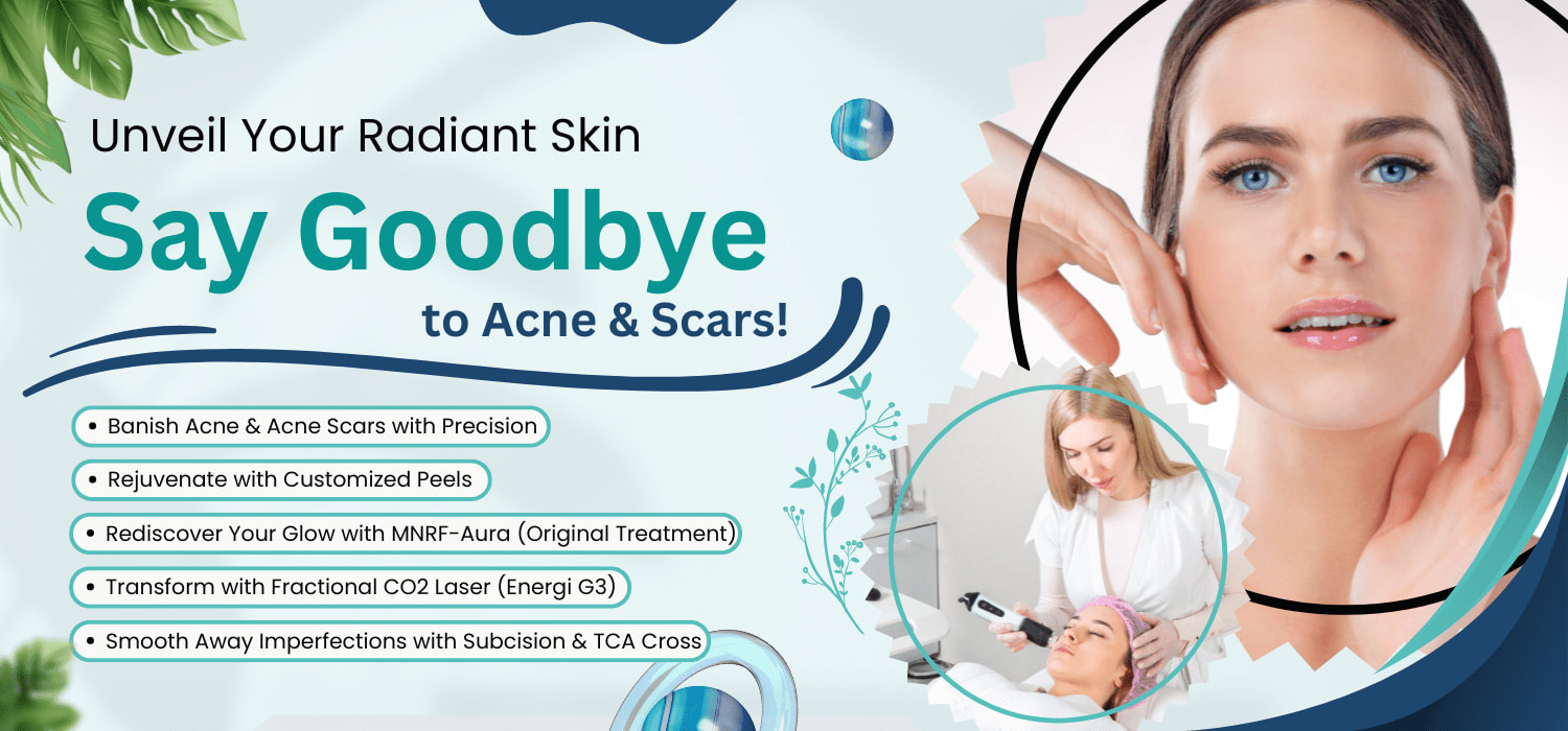 Best Acne Scar Treatment in Jalandhar with Affordable Prices Dr
