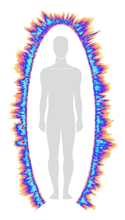 Bio-Well scan showing a thin, depleted energy field at 28 Joules before treatment