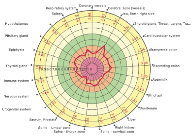 Energy area diagram showing a collapsed field indicating severe energy exhaustion before treatment