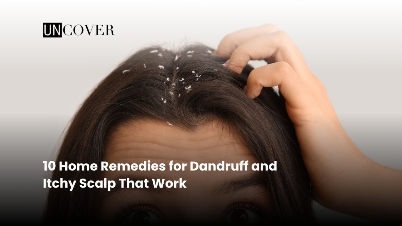 Featured image: 10 Home Remedies for Dandruff and Itchy Scalp That Work