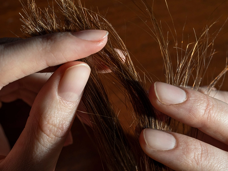 Featured image: How to stop Hair Breakage? Causes and solutions