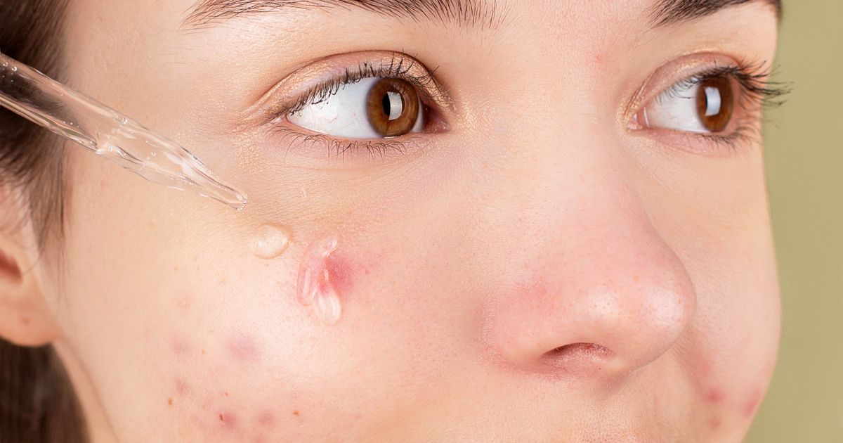 Vitamin C Serum vs Viên Uống — Đâu Là Lựa Chọn Tốt Hơn?