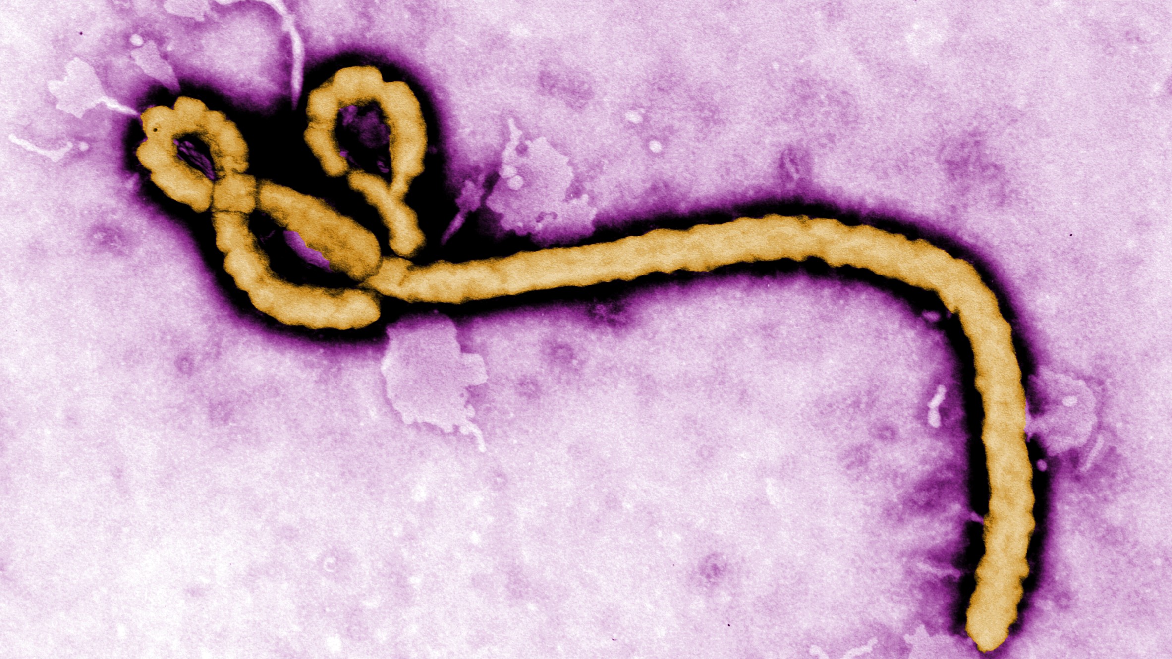 Ebola is a rare and severe viral illness caused by orthoebolaviruses, leading to viral hemorrhagic fever